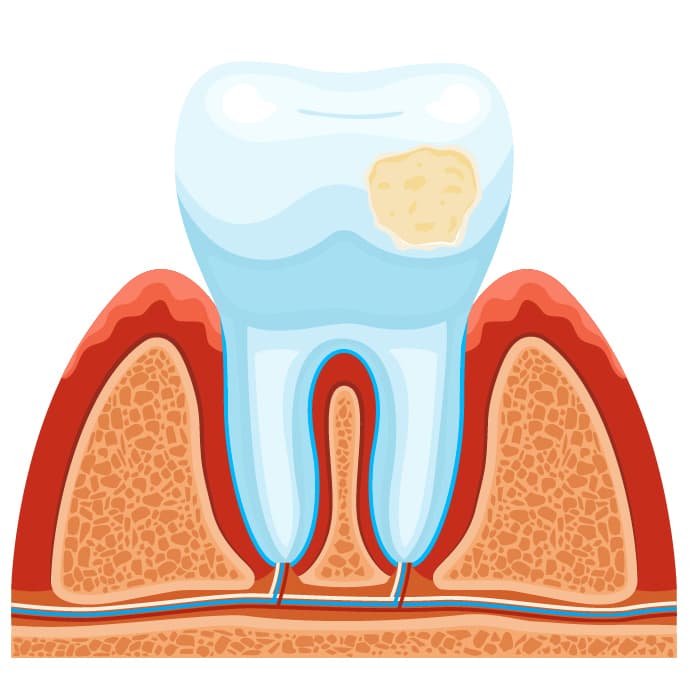 Детская стоматология - молочные зубы